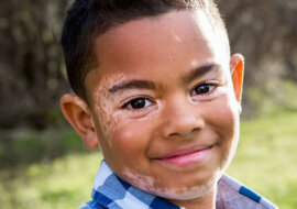 Chłopak spotkał przyjaciela w nieszczęściu i pokonał kompleksy