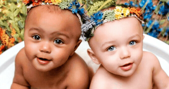 Bliźniaczki, które urodziły się z różnymi kolorami skóry, mają już 25 lat